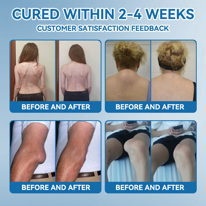 🌿﻿𝐟𝐥𝐲𝐬𝐦𝐮𝐬® 𝐁𝐏𝐂-𝟏𝟓𝟕 𝐉𝐨𝐢𝐧𝐭 𝐇𝐞𝐚𝐥𝐢𝐧𝐠 𝐂𝐫𝐞𝐚𝐦🦴Treats Arthritis, Neuropathy, Rheumatism, Sports Injuries & More🏆