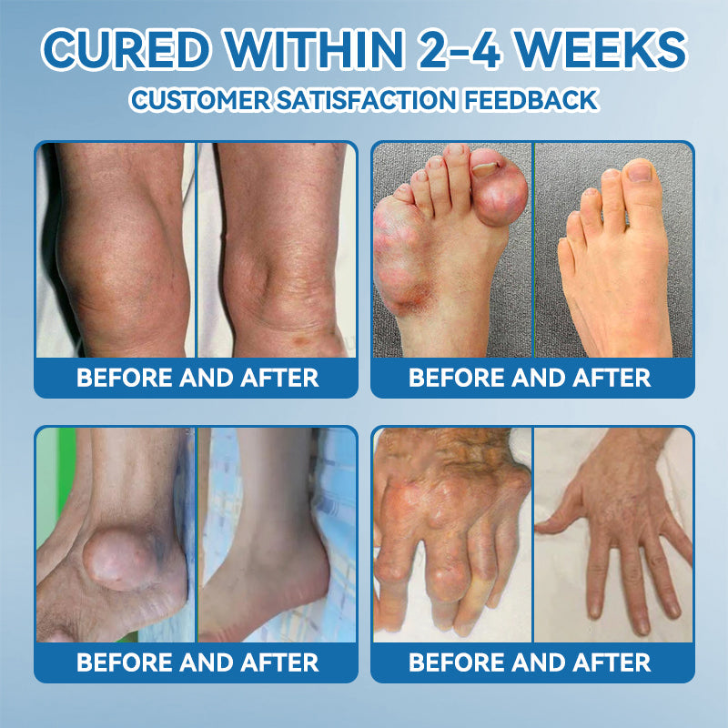 🌿﻿𝐟𝐥𝐲𝐬𝐦𝐮𝐬® 𝐁𝐏𝐂-𝟏𝟓𝟕 𝐉𝐨𝐢𝐧𝐭 𝐇𝐞𝐚𝐥𝐢𝐧𝐠 𝐂𝐫𝐞𝐚𝐦🦴Treats Arthritis, Neuropathy, Rheumatism, Sports Injuries & More🏆