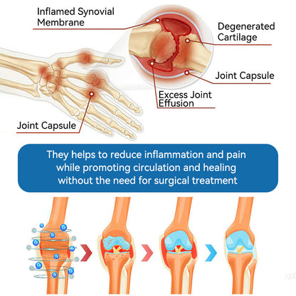 🌿﻿𝐟𝐥𝐲𝐬𝐦𝐮𝐬® 𝐁𝐏𝐂-𝟏𝟓𝟕 𝐉𝐨𝐢𝐧𝐭 𝐇𝐞𝐚𝐥𝐢𝐧𝐠 𝐂𝐫𝐞𝐚𝐦🦴Treats Arthritis, Neuropathy, Rheumatism, Sports Injuries & More🏆