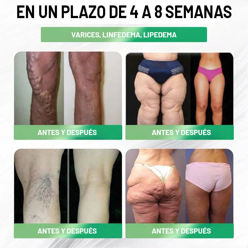 【Último día de promoción: 60% DE DESCUENTO🏅】CVREOZ® Parche NANO de microagujas NIDDK-Tirzepatide para Adelgazar y Salud(Sin dolor, liberación 24/7 | Pierde 9 kg RÁPIDO | Reducción del 90% en azúcar | )