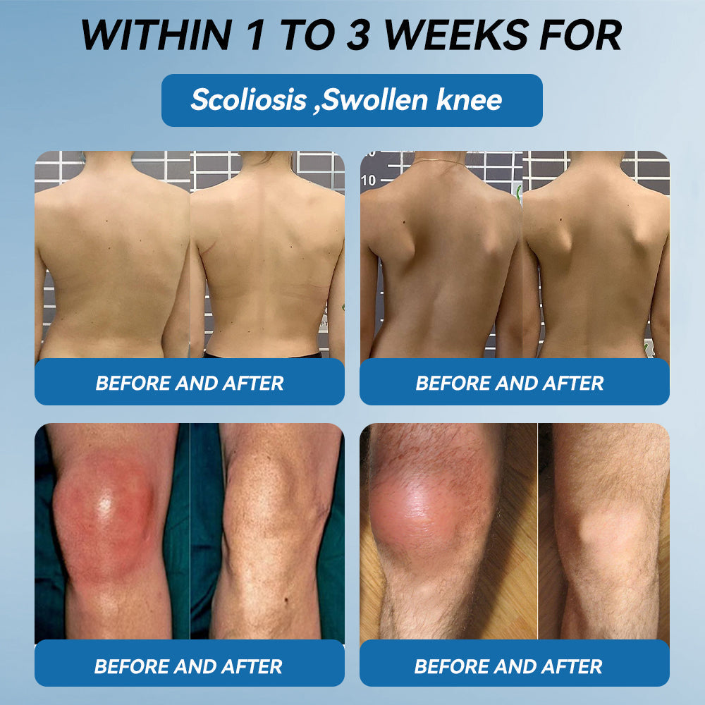 🌿﻿𝐟𝐥𝐲𝐬𝐦𝐮𝐬® 𝐁𝐏𝐂-𝟏𝟓𝟕 𝐉𝐨𝐢𝐧𝐭 𝐇𝐞𝐚𝐥𝐢𝐧𝐠 𝐂𝐫𝐞𝐚𝐦🦴Treats Arthritis, Neuropathy, Rheumatism, Sports Injuries & More🏆