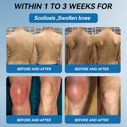 🌿﻿𝐟𝐥𝐲𝐬𝐦𝐮𝐬® 𝐁𝐏𝐂-𝟏𝟓𝟕 𝐉𝐨𝐢𝐧𝐭 𝐇𝐞𝐚𝐥𝐢𝐧𝐠 𝐂𝐫𝐞𝐚𝐦🦴Treats Arthritis, Neuropathy, Rheumatism, Sports Injuries & More🏆