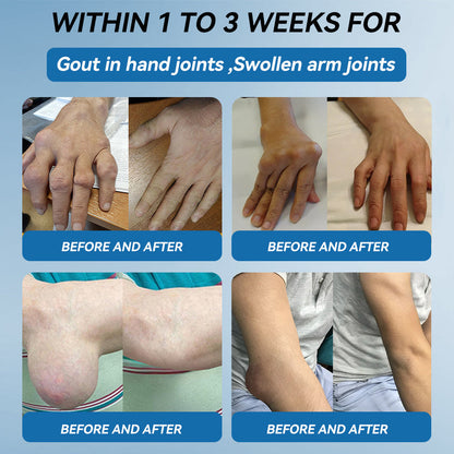 🌿﻿𝐟𝐥𝐲𝐬𝐦𝐮𝐬® 𝐁𝐏𝐂-𝟏𝟓𝟕 𝐉𝐨𝐢𝐧𝐭 𝐇𝐞𝐚𝐥𝐢𝐧𝐠 𝐂𝐫𝐞𝐚𝐦🦴Treats Arthritis, Neuropathy, Rheumatism, Sports Injuries & More🏆