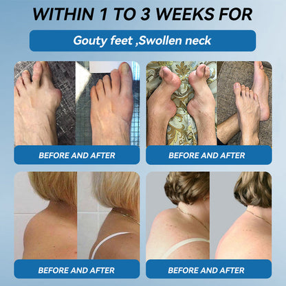 🌿﻿𝐟𝐥𝐲𝐬𝐦𝐮𝐬® 𝐁𝐏𝐂-𝟏𝟓𝟕 𝐉𝐨𝐢𝐧𝐭 𝐇𝐞𝐚𝐥𝐢𝐧𝐠 𝐂𝐫𝐞𝐚𝐦🦴Treats Arthritis, Neuropathy, Rheumatism, Sports Injuries & More🏆